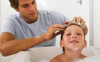 Что делать при появлении перхоти у ребенка