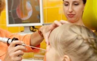 Нужна ли операция при разрастании аденоидов?