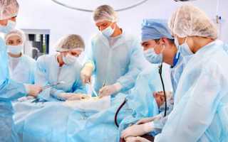 Можно ли делать операцию во время месячных: советы гинеколога.