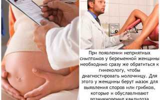 Чем опасна молочница при беременности и как от нее избавиться