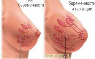 Боль в груди при беременности