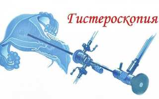 Можно ли забеременеть после удаления полипа эндометрия матки гистероскопическим методом и когда можно планировать зачатие