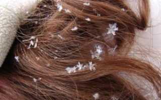 Перхоть при беременности: как от нее избавиться?