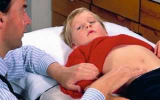 Аппендицит: признаки, лечение