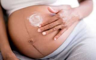 Элидел при беременности: только при крайней необходимости