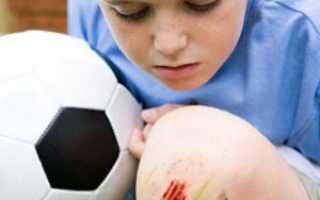 Почему у ребенка могут болеть колени?