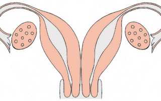 Двурогая матка: можно ли забеременеть при такой патологии?