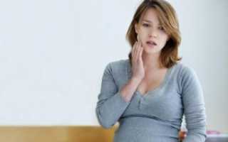 Нужно ли лечить флюс во время беременности?