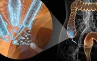 Как восстановить после антибиотиков микрофлору кишечника