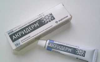 Акридерм при беременности, оцениваем риски гормонального крема