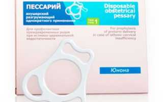 Пессарий при беременности: зачем он нужен?