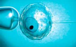 Экстракорпоральное оплодотворение: что такое ЭКО?
