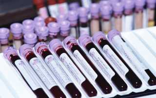 Зачем делать коагулограмму во время беременности