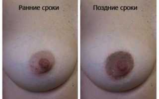 На каком сроке беременности начинает наливаться грудь. Набухание молочных желез при беременности