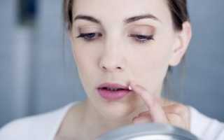 Простуда на губах в период беременности: опасность и варианты лечения