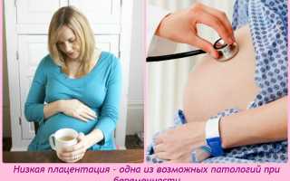 Чем опасна низкая плацентация во время беременности