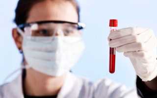 Гемостазиограмма при беременности: что это такое?