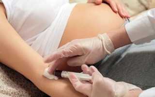 Что означает изменение уровня билирубина в кровотоке у беременной?