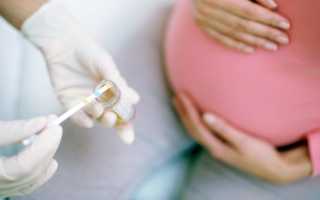 Чем опасна кетонурия при беременности?