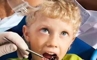 Что делать, когда у ребенка кровоточит десна