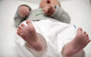 Лечение плоскостопия у детей в домашних условиях