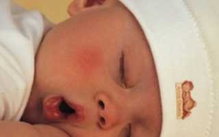 Как бороться с детским храпом