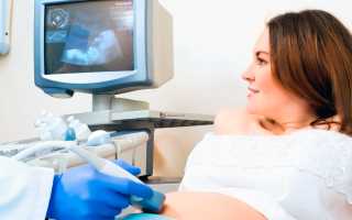 Когда делают второй скрининг при беременности