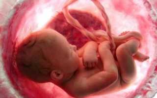 Взвесь в околоплодных водах: современные методы диагностики и терапии