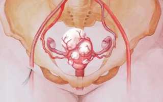 Кому для лечения миомы назначают противозачаточные таблетки?