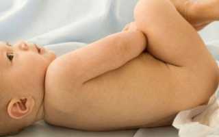 У грудничка на губах и языке белые пятнышки