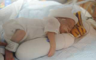 Из-за чего возникает и чем опасна гипотрофия плода