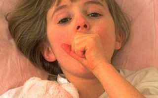 Лечение обструктивного бронхита у ребенка