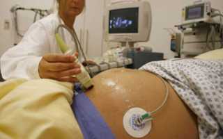 Чем грозит преждевременное старение плаценты