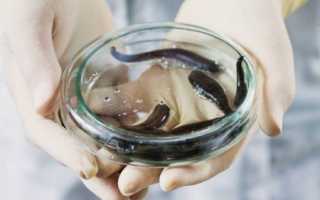 Эффективность гирудотерапии при бесплодии и ее безопасность при беременности