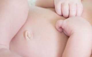 Почему у грудничка потемнел пупок