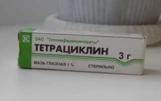 Безопасна ли тетрациклиновая мазь при беременности?