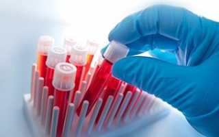 Низкий гематокрит при беременности и способы его нормализации