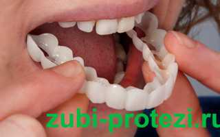 Протезирование зубов: искусство возвращения безупречной улыбки