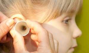 Практикум для мам: устраняем лишнюю серу в ушах