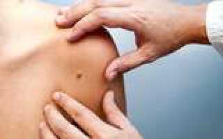 Септисол при беременности: особенности применения