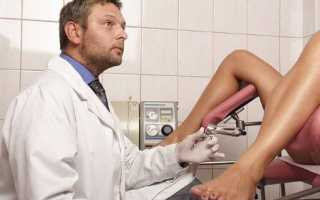 Метастазирование при злокачественных опухолях яичника