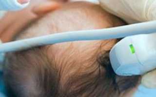 Для чего делают УЗИ головного мозга грудничку?