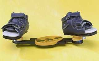 Врожденная косолапость у детей при ходьбе: признаки, лечение, если ребенок косолапит