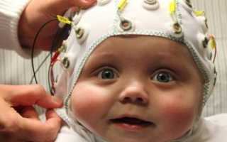 Что такое аутизм и как его диагностируют?