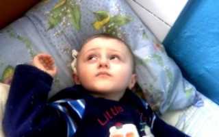 Что делать: обнаружена киста головного мозга