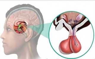 Одна из самых частых проблем гипофиза — пролактинома: признаки, терапия