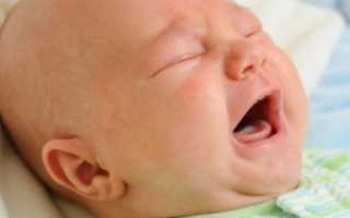 Синдром гипервозбудимости у грудничка