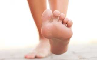 Грибковые инфекции при беременности: методы лечения грибка