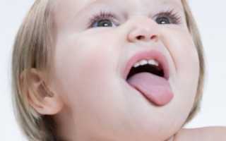 Красные точки на кончике языка у грудничка