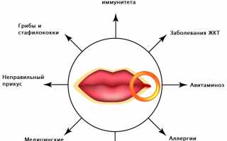 Из-за чего возникают в уголках губ болячки